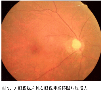 ZY016_154_4.gif